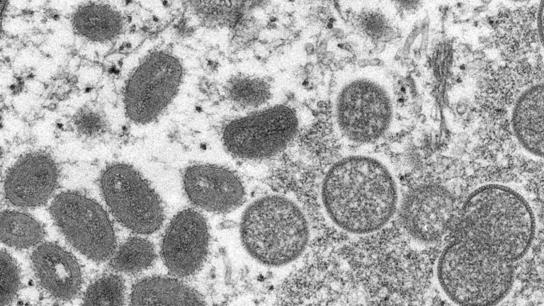 Monkeypox cases increase globally